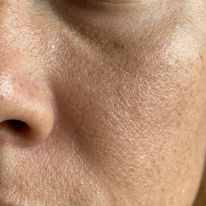 Skin That Never Feels Truly Smooth